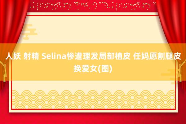 人妖 射精 Selina惨遭理发局部植皮 任妈愿割腿皮换爱女(图)